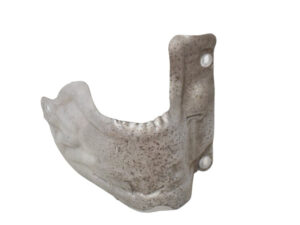 9806792780 CARTER PROTEZIONE DI CALORE CITROEN C3 Serie diesel